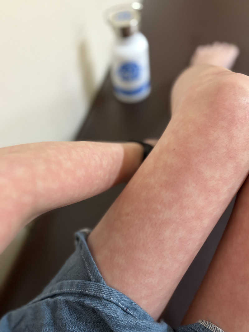 きりんちゃんさんの網走ロイヤルホテル(サウナ&風呂のはまなす)のサ活写真