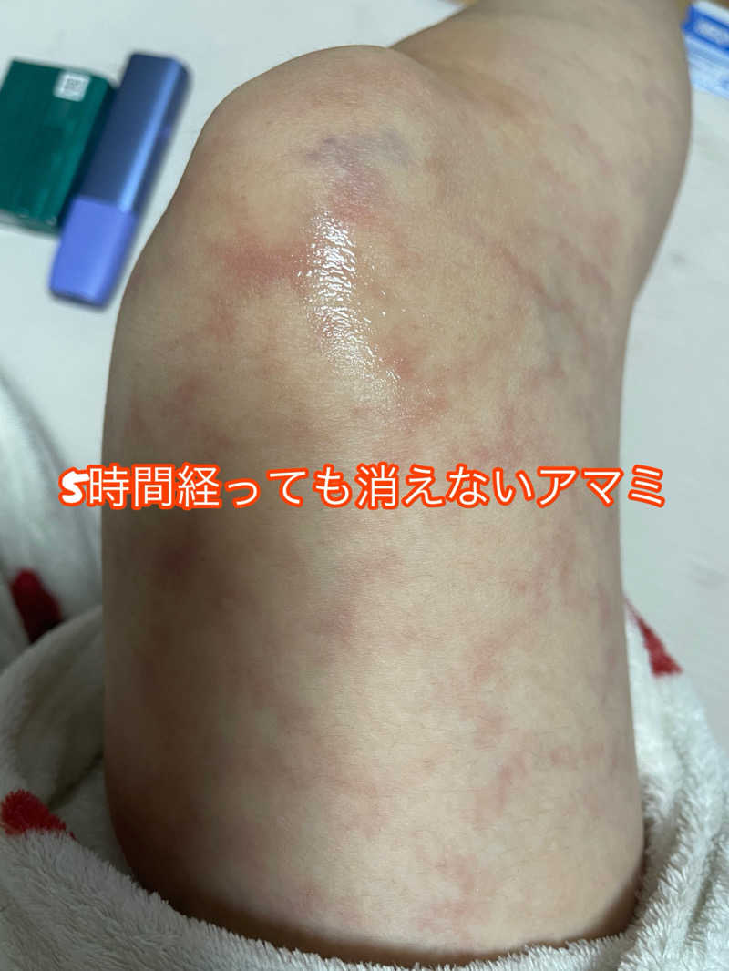 弱小猫ビームさんのSOLO37のサ活写真