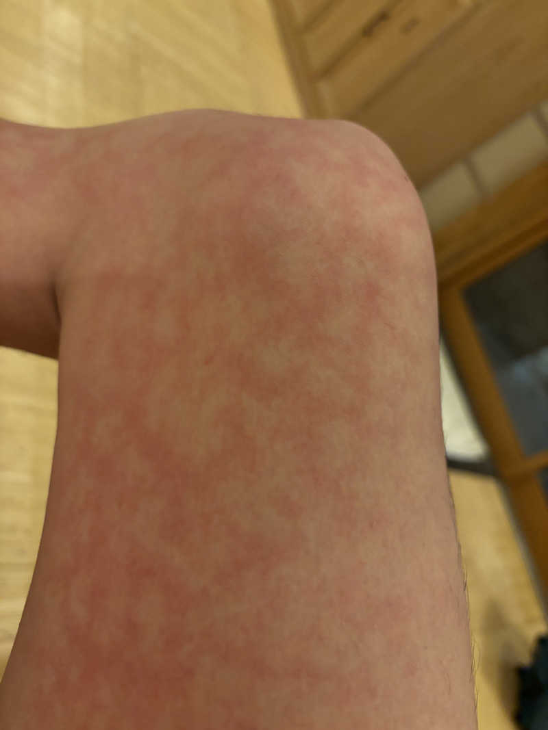 とさんのSPABLIC 赤坂湯屋のサ活写真