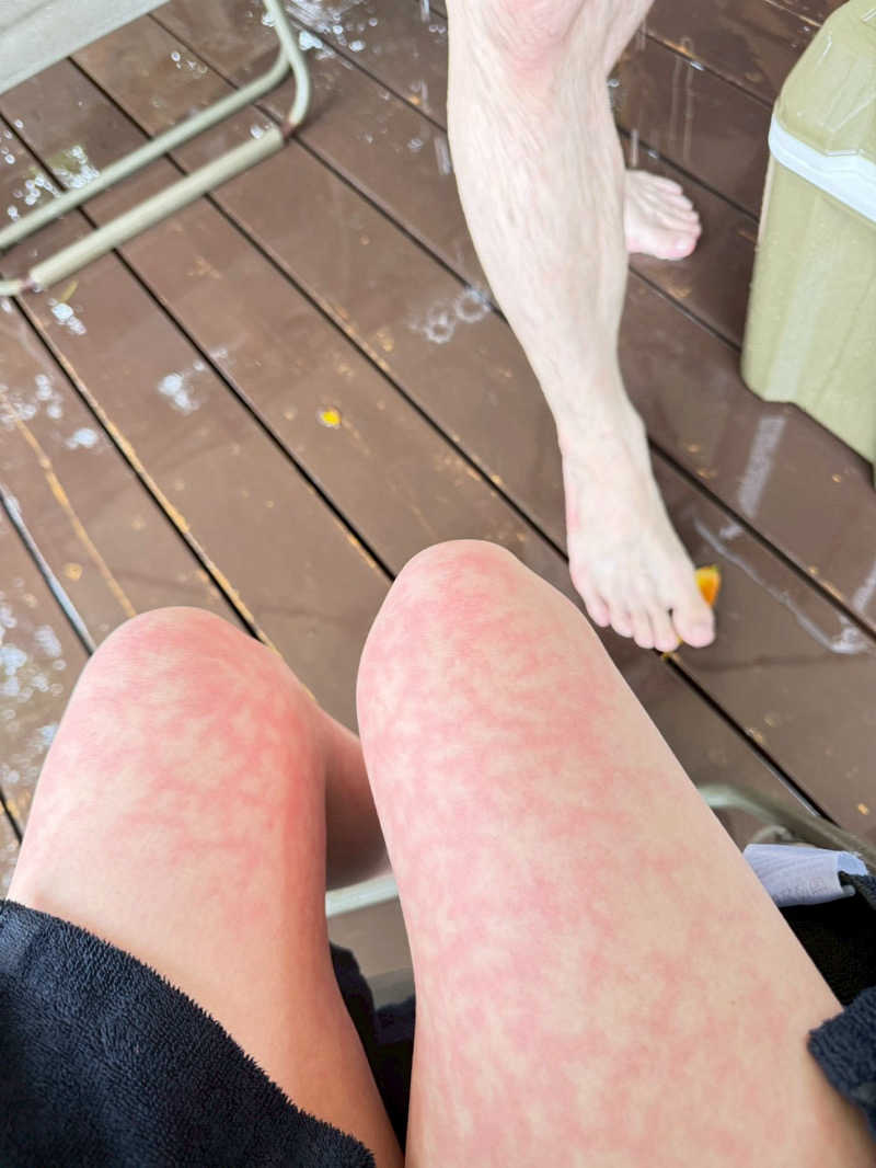 湯人28号さんの鹿とサウナのサ活写真