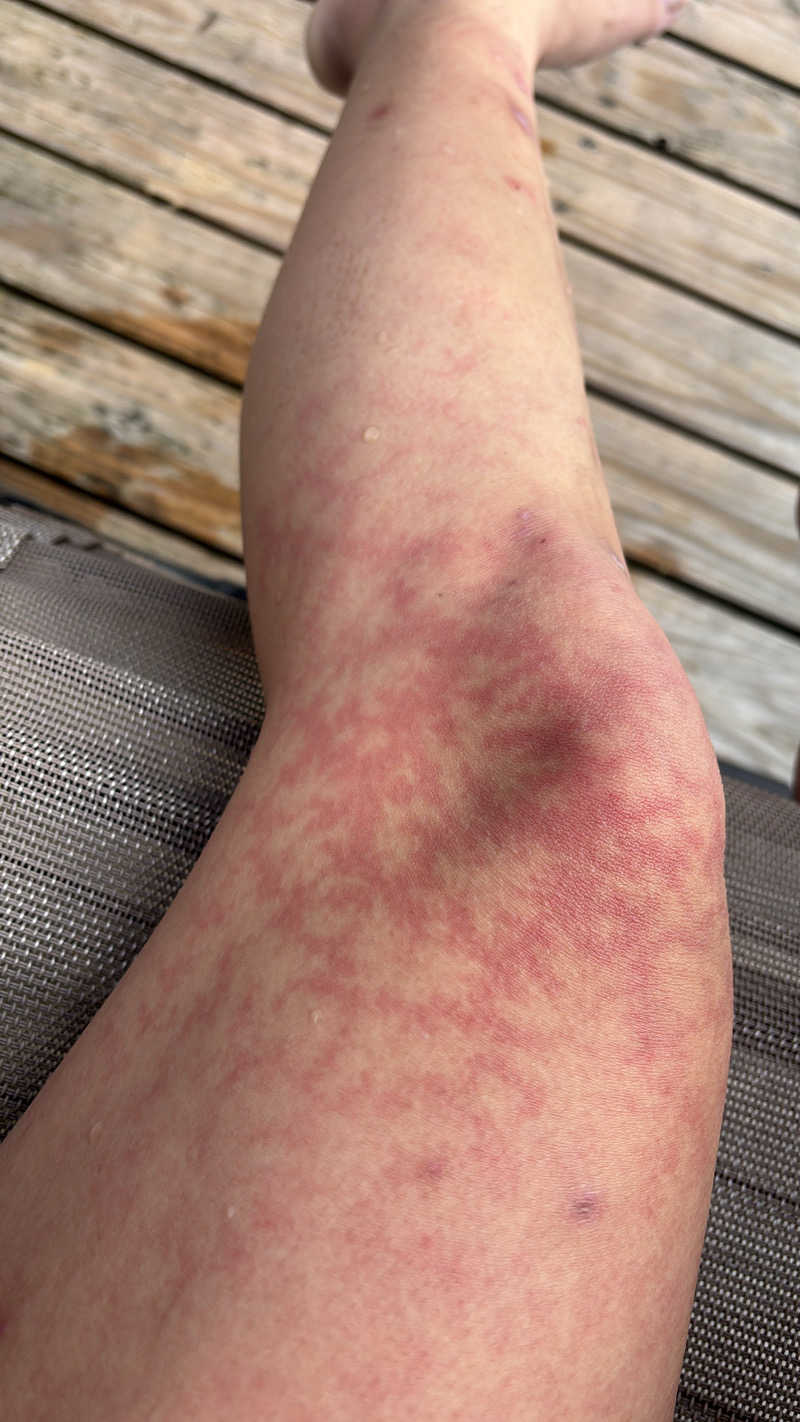 𝙆𝙐𝙍𝙐𝙈𝙄さんの湯屋 FUROBAKKA(フロバッカ)のサ活写真