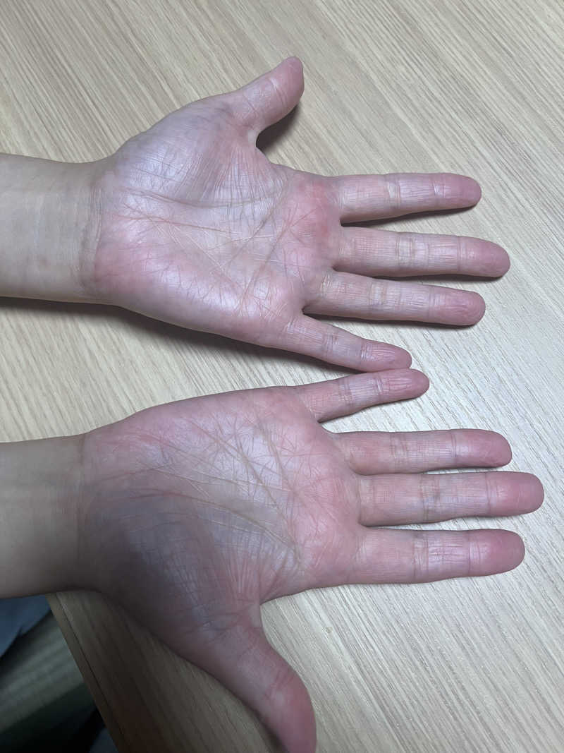 無双サウファー旅人🌏🚙✨さんの緑の風 リゾート きたゆざわのサ活写真